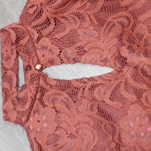 Forever 21 Lacey Dress - Picture 8 of 12